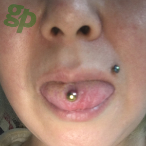 �Ǌ�̑V�g����̌��E��s�A�X /�}�h���i��